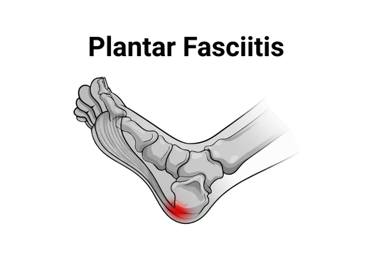 Why Your Heel Hurts and What You Can Do About It