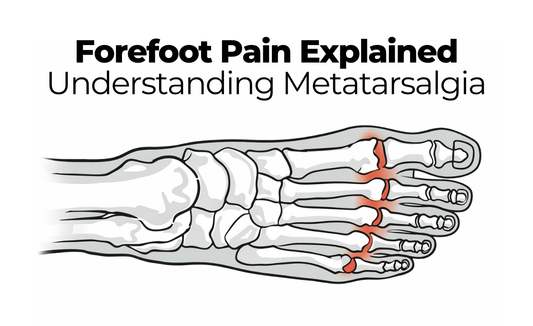 Forefoot Pain Explained: Understanding Metatarsalgia
